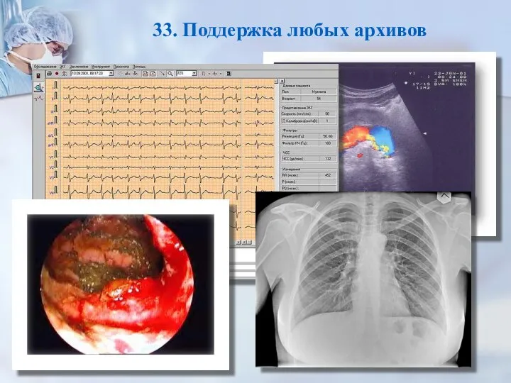 33. Поддержка любых архивов