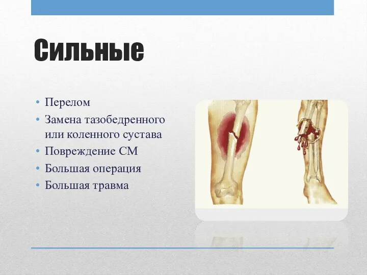 Сильные Перелом Замена тазобедренного или коленного сустава Повреждение СМ Большая операция Большая травма