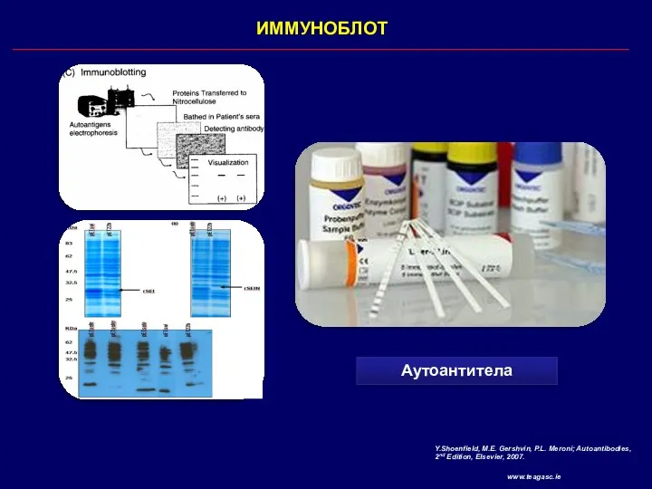 ИММУНОБЛОТ Аутоантитела Y.Shoenfield, M.E. Gershvin, P.L. Meroni; Autoantibodies, 2nd Edition, Elsevier, 2007. www.teagasc.ie