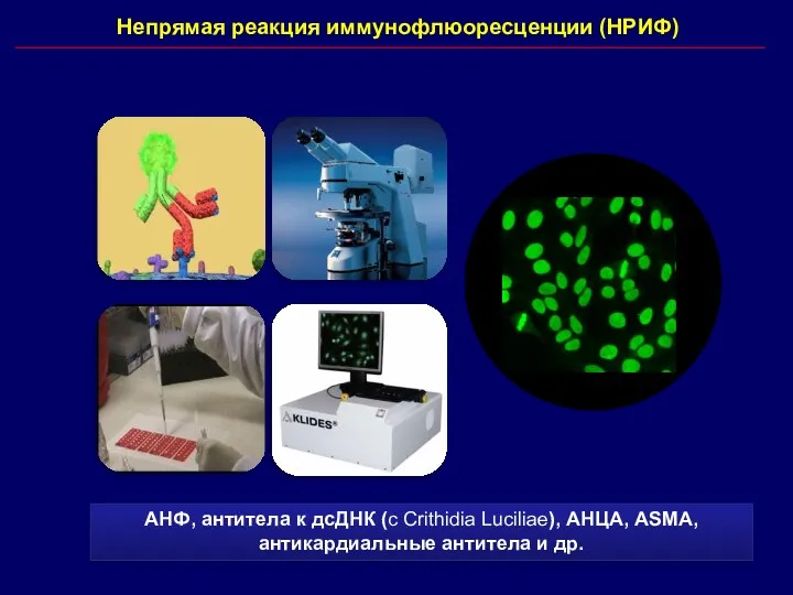 Непрямая реакция иммунофлюоресценции (НРИФ) АНФ, антитела к дсДНК (с Crithidia