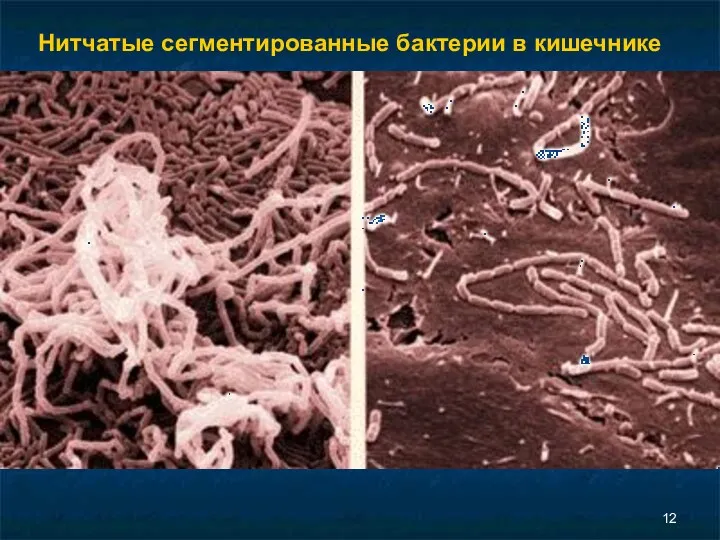 Нитчатые сегментированные бактерии в кишечнике