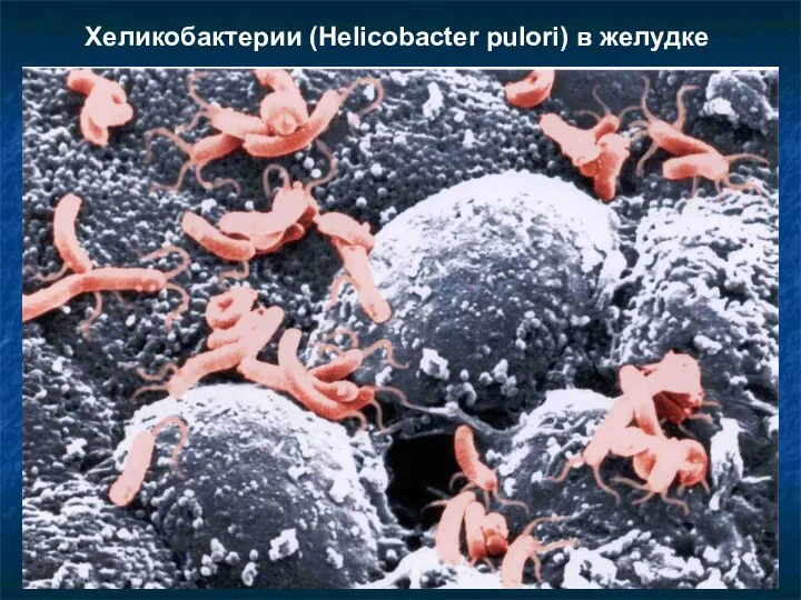 Хеликобактерии (Helicobacter pulori) в желудке