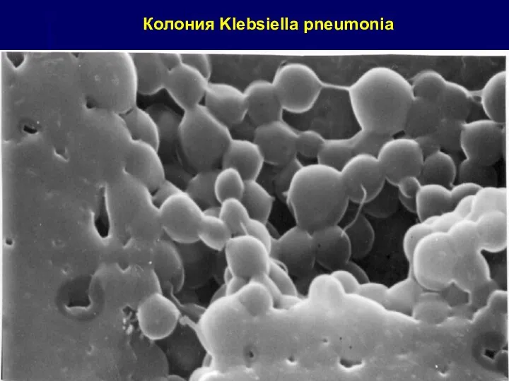 Колония Klebsiella pneumonia