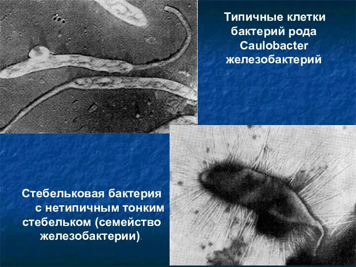 Типичные клетки бактерий рода Caulobacter железобактерий Стебельковая бактерия с нетипичным тонким стебельком (семейство железобактерии).