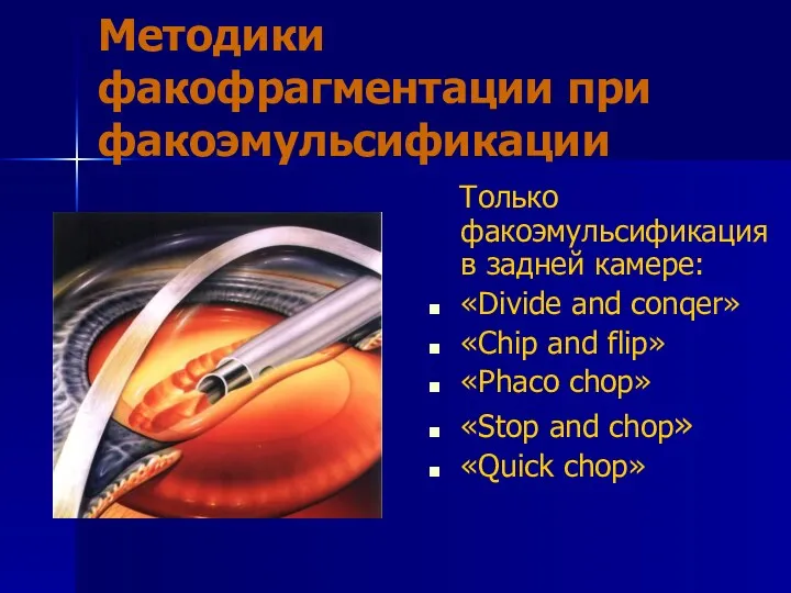 Методики факофрагментации при факоэмульсификации Только факоэмульсификация в задней камере: «Divide