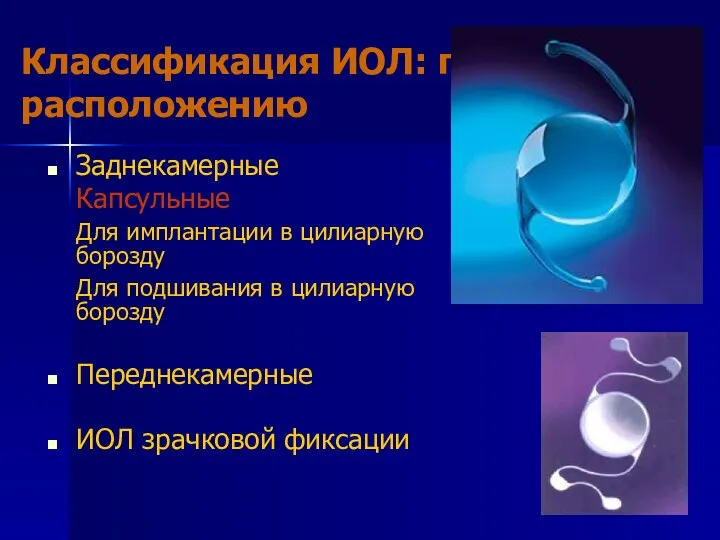 Классификация ИОЛ: по расположению Заднекамерные Капсульные Для имплантации в цилиарную