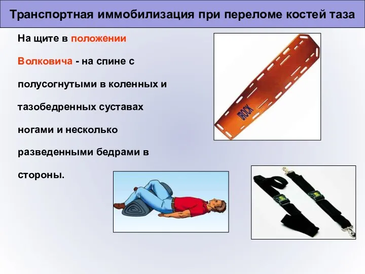 Транспортная иммобилизация при переломе костей таза На щите в положении