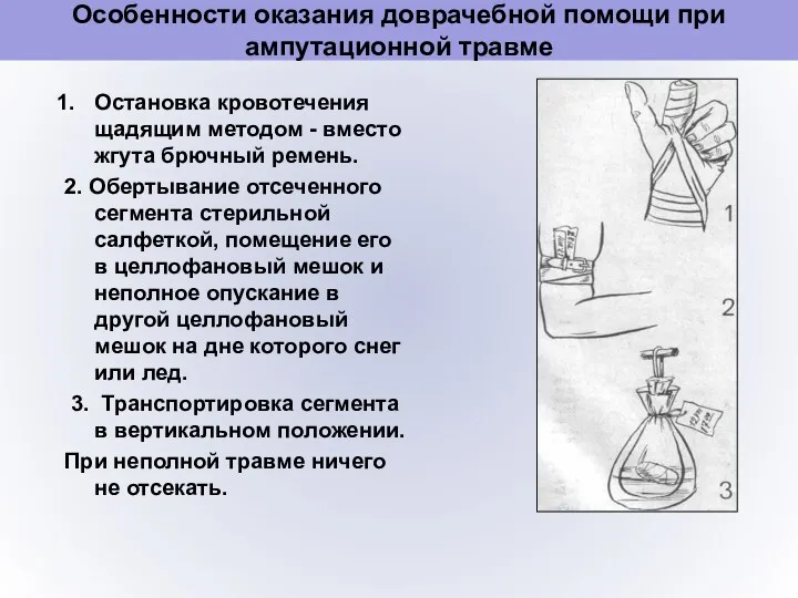 Особенности оказания доврачебной помощи при ампутационной травме Остановка кровотечения щадящим