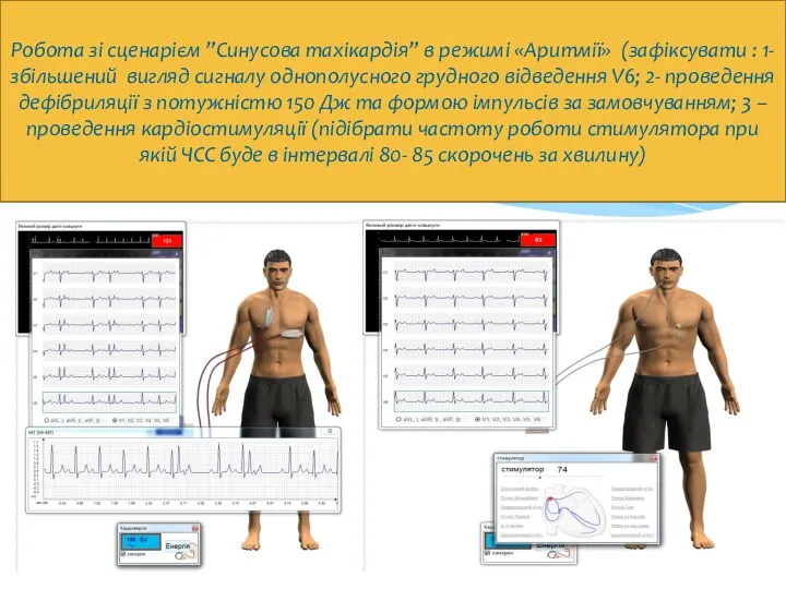 Робота зі сценарієм ”Синусова тахікардія” в режимі «Аритмії» (зафіксувати :