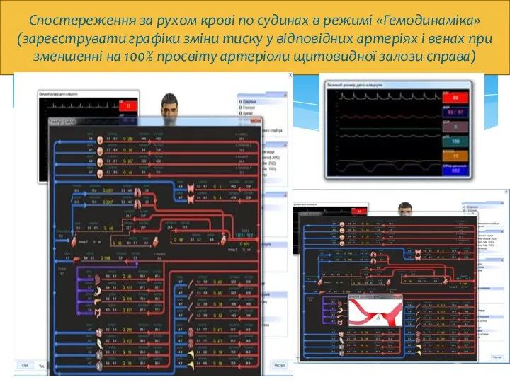 Спостереження за рухом крові по судинах в режимі «Гемодинаміка» (зареєструвати