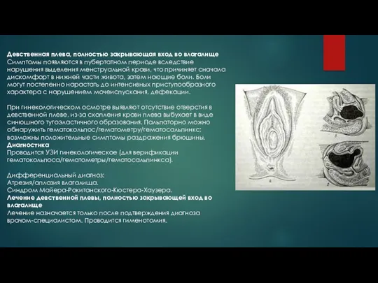Девственная плева, полностью закрывающая вход во влагалище Симптомы появляются в