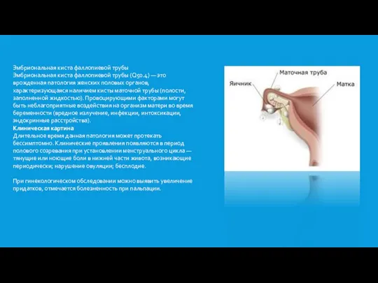 Эмбриональная киста фаллопиевой трубы Эмбриональная киста фаллопиевой трубы (Q50.4) —