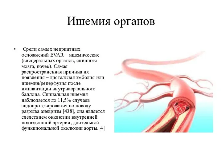 Ишемия органов Среди самых неприятных осложнений EVAR – ишемические (висцеральных