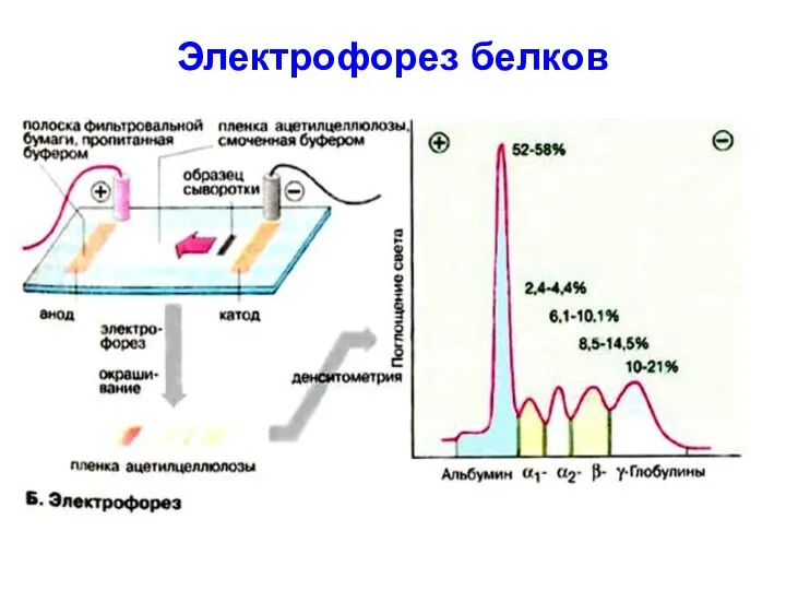 Электрофорез белков