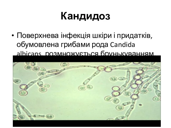 Кандидоз Поверхнева інфекція шкіри і придатків, обумовлена грибами рода Candida albicans, розмножується брунькуванням.