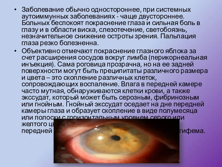 Заболевание обычно одностороннее, при системных аутоиммунных заболеваниях - чаще двустороннее.