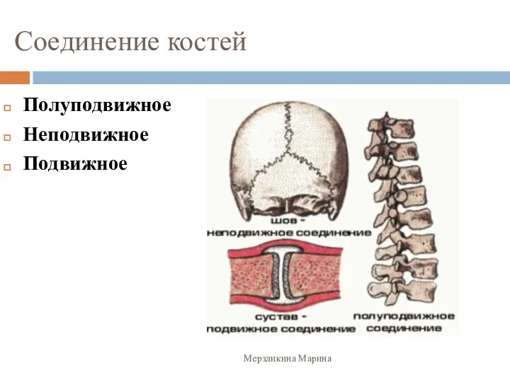 Соединение костей Полуподвижное Неподвижное Подвижное Мерзликина Марина