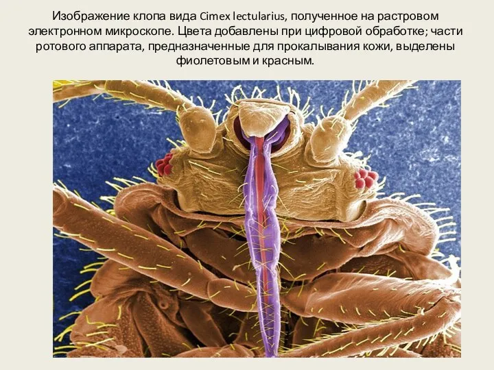 Изображение клопа вида Cimex lectularius, полученное на растровом электронном микроскопе.