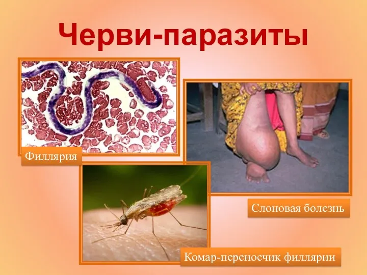 Черви-паразиты Слоновая болезнь Комар-переносчик филлярии Филлярия