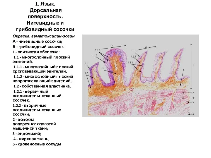 1. Язык. Дорсальная поверхность. Нитевидные и грибовидный сосочки Окраска: гематоксилин-эозин