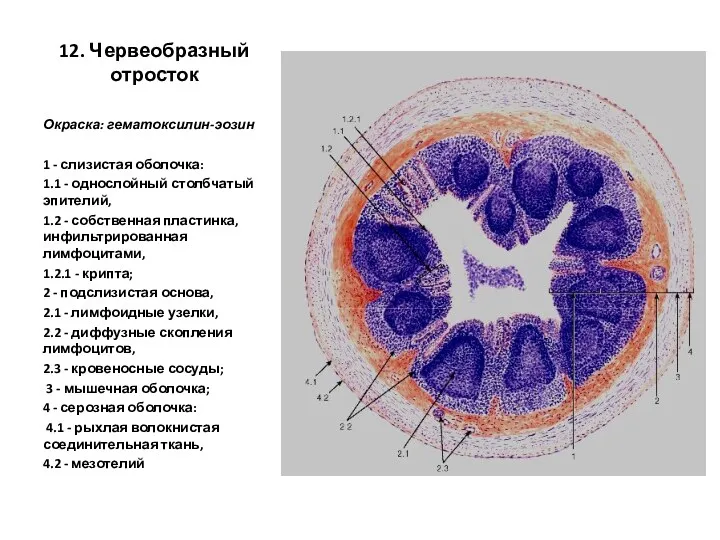 12. Червеобразный отросток Окраска: гематоксилин-эозин 1 - слизистая оболочка: 1.1