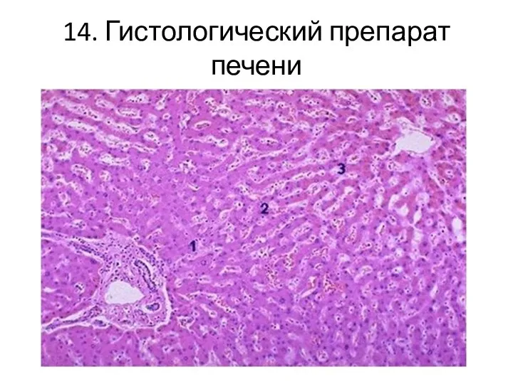 14. Гистологический препарат печени