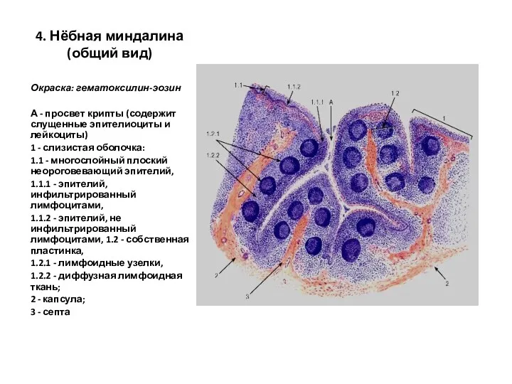 4. Нёбная миндалина (общий вид) Окраска: гематоксилин-эозин А - просвет