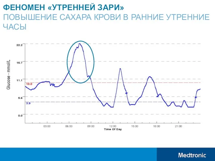 ФЕНОМЕН «УТРЕННЕЙ ЗАРИ» ПОВЫШЕНИЕ САХАРА КРОВИ В РАННИЕ УТРЕННИЕ ЧАСЫ