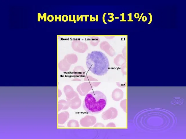 Моноциты (3-11%)