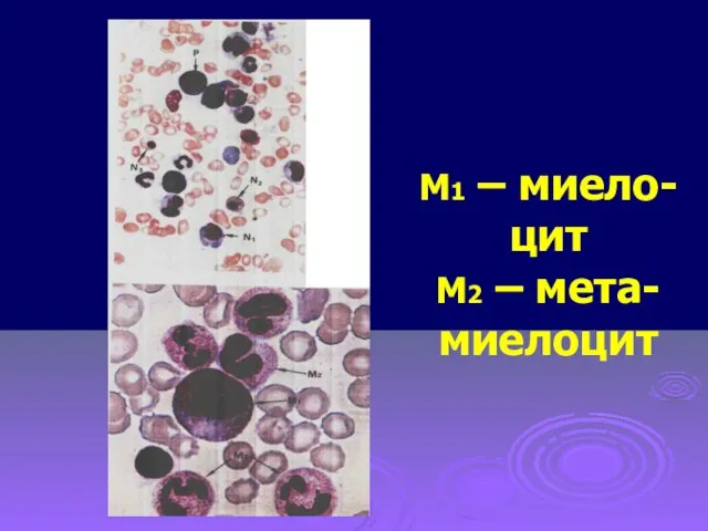 М1 – миело-цит М2 – мета-миелоцит