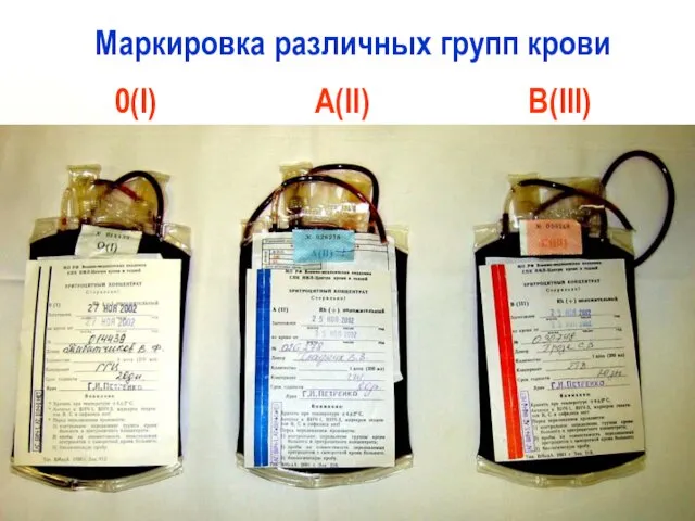 Маркировка различных групп крови 0(I) A(II) B(III)