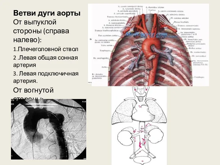 Ветви дуги аорты От выпуклой стороны (справа налево): 1.Плечеголовной ствол 2 .Левая общая