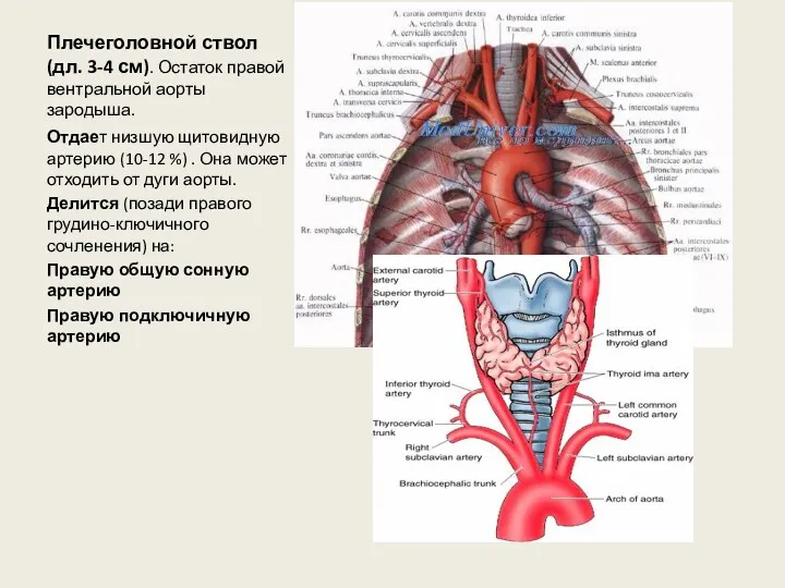 Плечеголовной ствол (дл. 3-4 см). Остаток правой вентральной аорты зародыша. Отдает низшую щитовидную