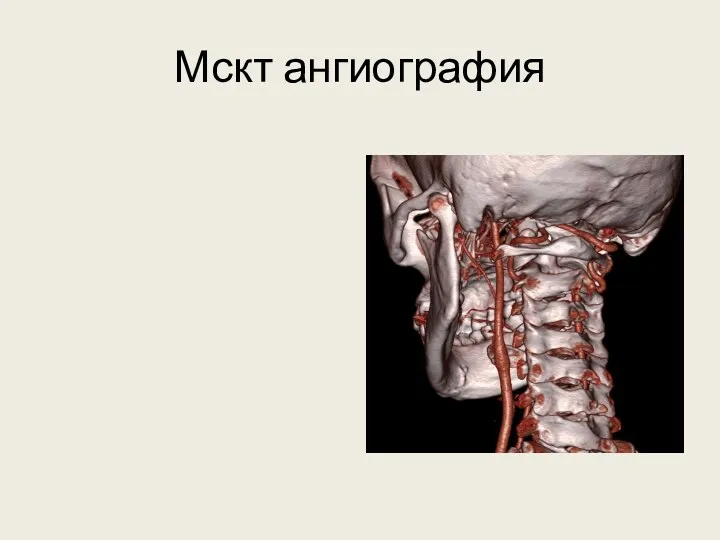 Мскт ангиография