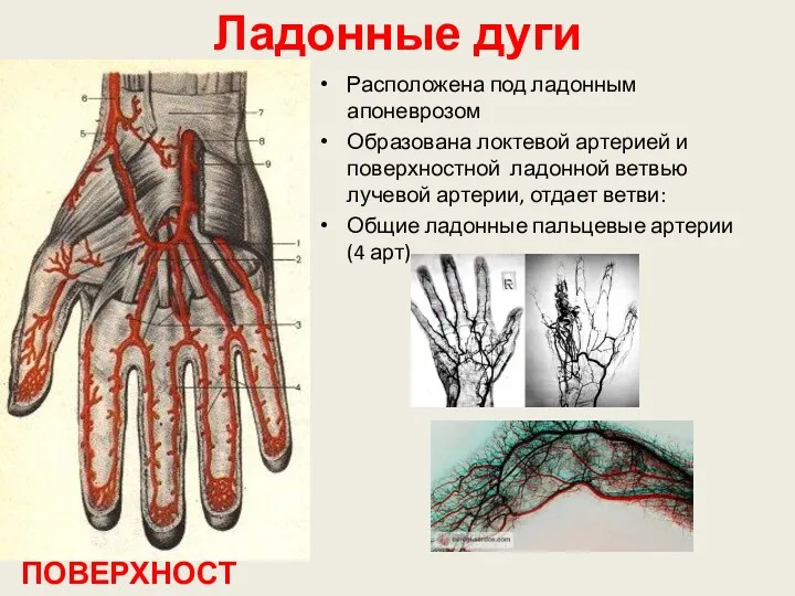 Ладонные дуги ПОВЕРХНОСТНАЯ Расположена под ладонным апоневрозом Образована локтевой артерией и поверхностной ладонной