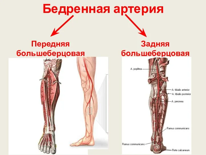 Бедренная артерия Передняя большеберцовая артерия Задняя большеберцовая артерия