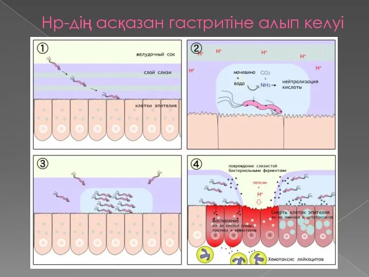 Нр-дің асқазан гастритіне алып келуі