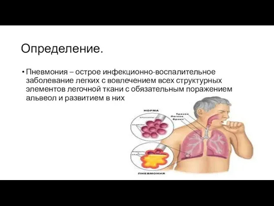 Определение. Пневмония – острое инфекционно-воспалительное заболевание легких с вовлечением всех структурных элементов легочной