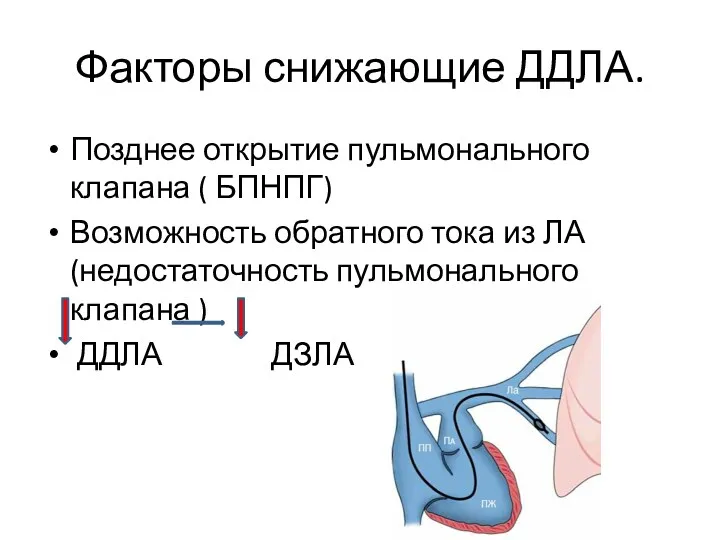 Факторы снижающие ДДЛА. Позднее открытие пульмонального клапана ( БПНПГ) Возможность