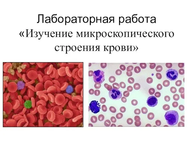 Лабораторная работа «Изучение микроскопического строения крови»