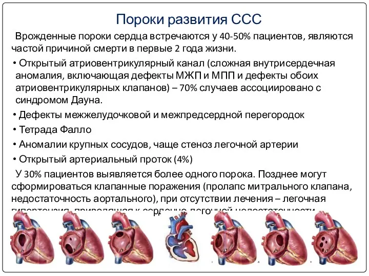 Врожденные пороки сердца встречаются у 40-50% пациентов, являются частой причиной смерти в первые