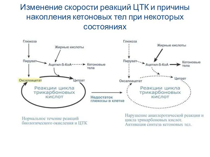 Изменение скорости реакций ЦТК и причины накопления кетоновых тел при некоторых состояниях