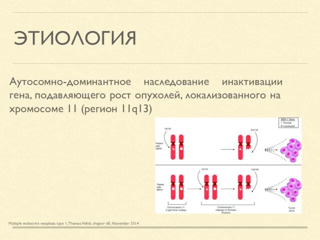 ЭТИОЛОГИЯ Аутосомно-доминантное наследование инактивации гена, подавляющего рост опухолей, локализованного на