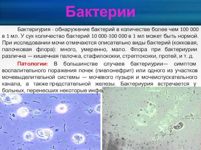 Бактериурия - обнаружение бактерий в количестве более чем 100 000