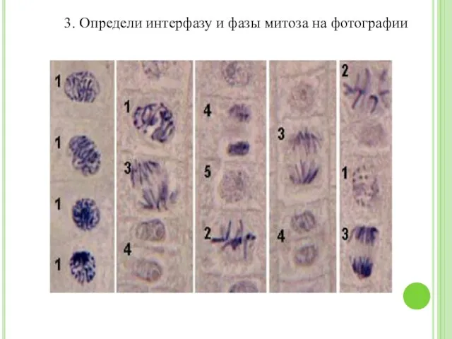 3. Определи интерфазу и фазы митоза на фотографии
