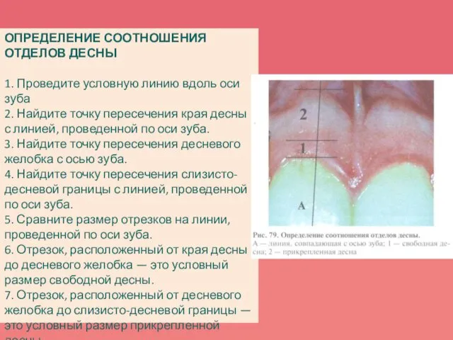 ОПРЕДЕЛЕНИЕ СООТНОШЕНИЯ ОТДЕЛОВ ДЕСНЫ 1. Проведите условную линию вдоль оси