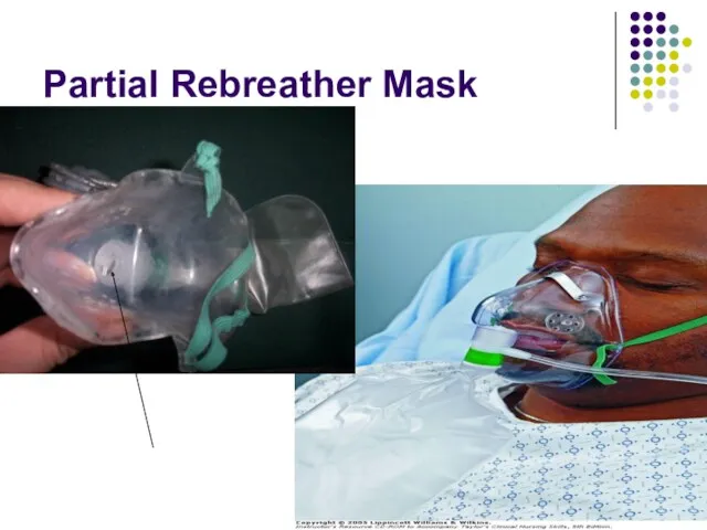 Partial Rebreather Mask