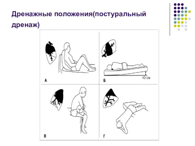 Дренажные положения(постуральный дренаж)