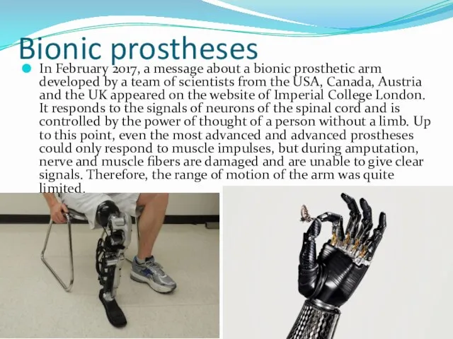Bionic prostheses In February 2017, a message about a bionic