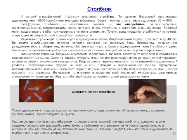 Опистотонус при столбняке Такие судороги могут сопровождаться западением языка, переломами